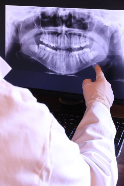 Best Broken or Chipped Tooth Repair in Mulberry, OH
