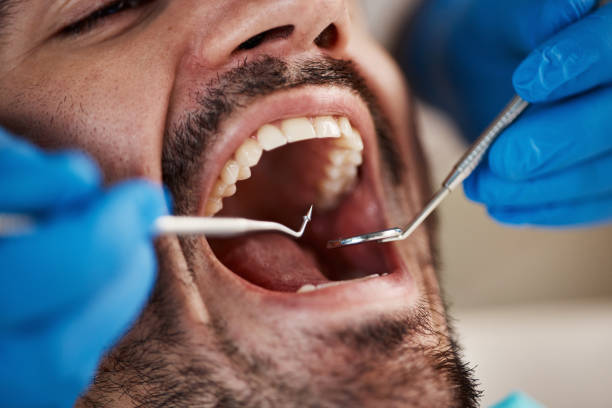 Best Emergency Cosmetic Dentistry (e.g., broken veneers) in Mulberry, OH